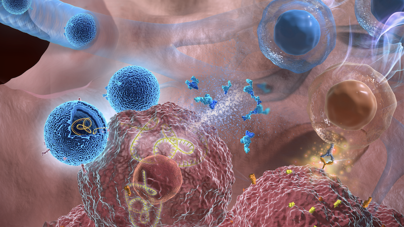 Illustration showing exosomes (blue) deliver IL-12 mRNA to lung cancer cells (brown). 