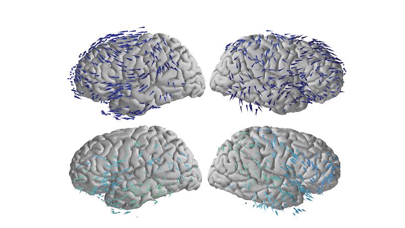 Four illustrations of the human brain with arrows indicating which direction information moves between regions.
