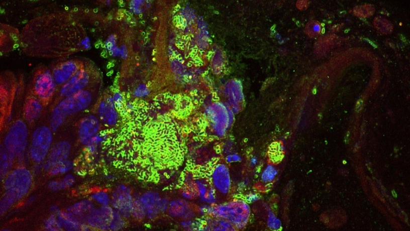 Immunofluorescent staining of colorectal cancer tumor bearing mouse fed engineered E. coli Nissle 1917