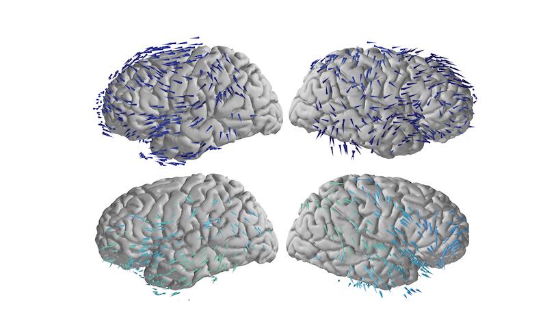 picture of brain wave activity