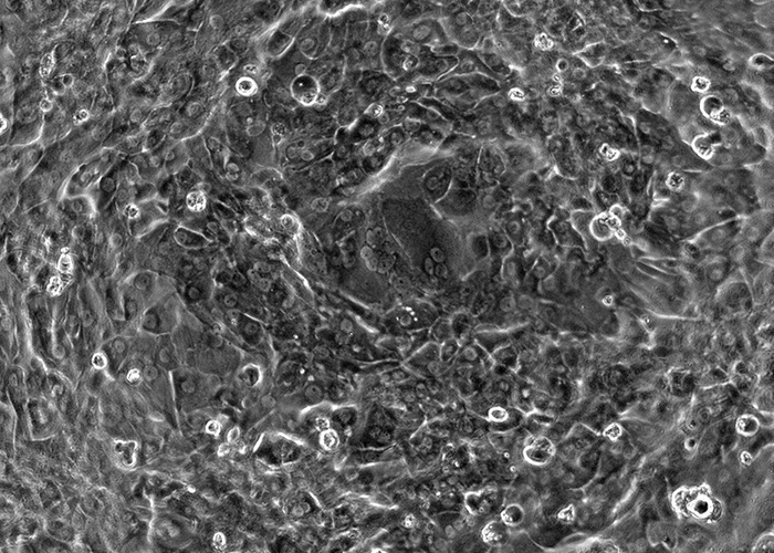 Cardiac muscle cells under a miscroscope