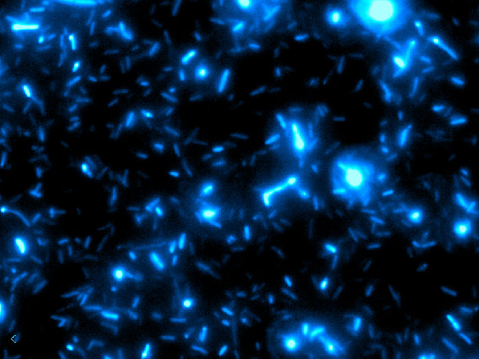 microscope image of bacteria
