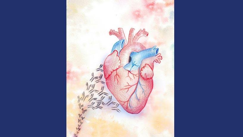 autoantibodies-attacking-the-heart-in-lupus-patient