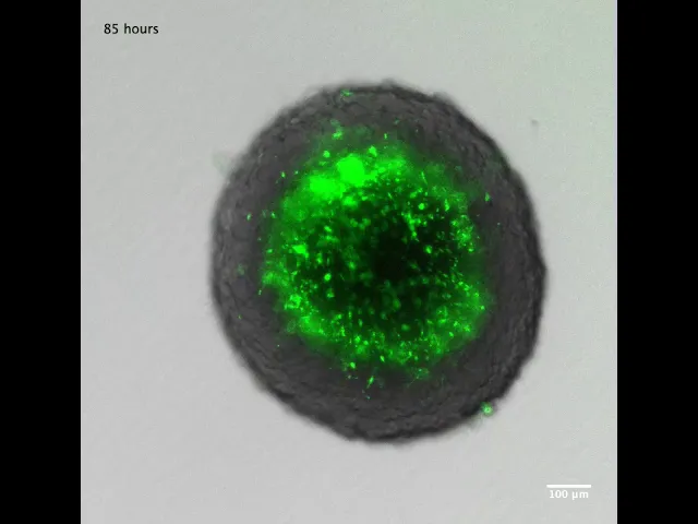 Bacterial Therapy in a Dish