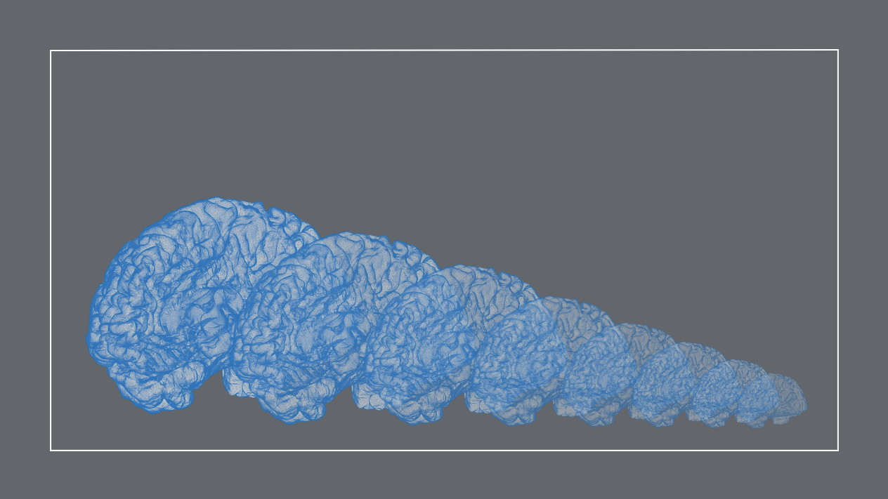 Illustrations of the human brain