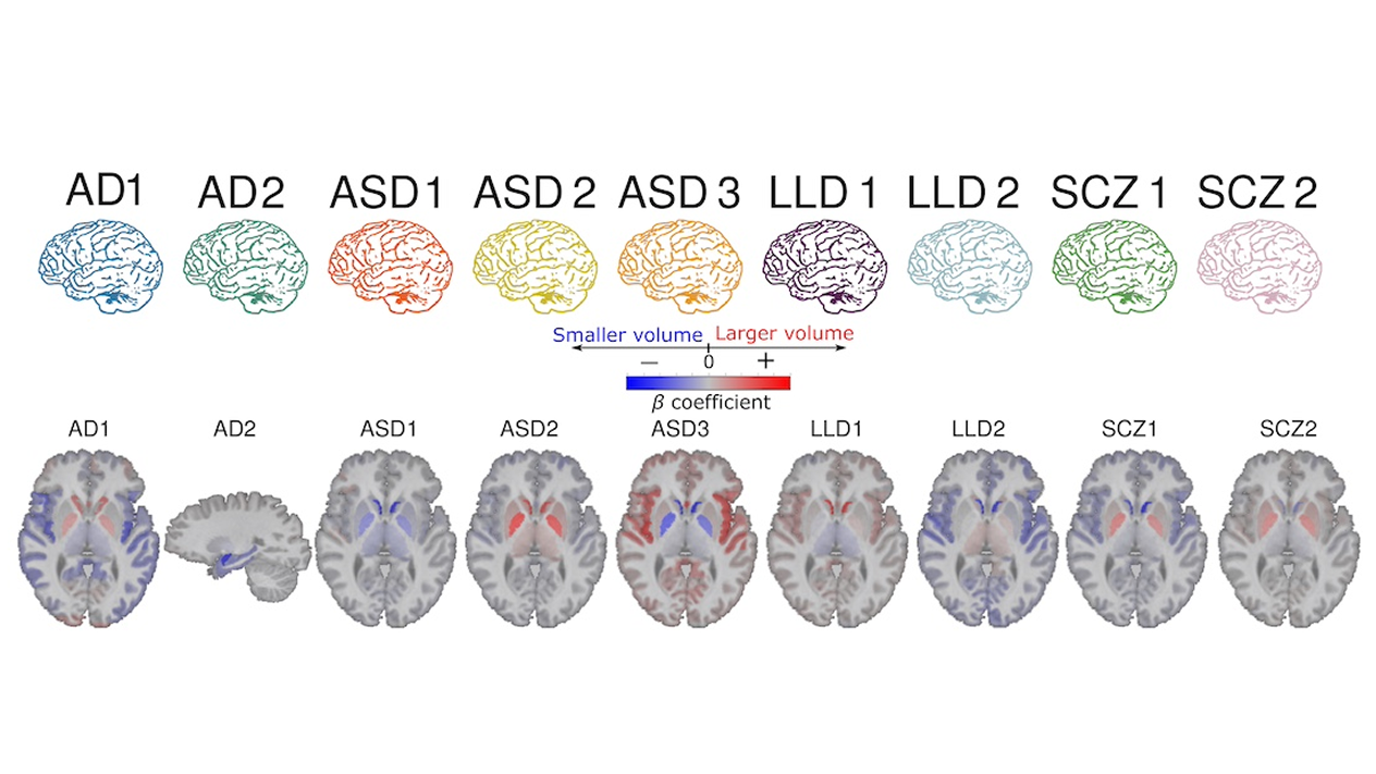 heatmaps showing brain regions where gray matter volume correlates with nine disorders