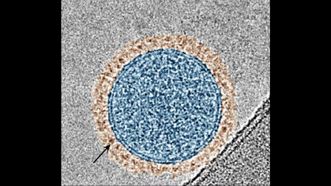 A color-enhanced microscope image showing an exosome (in blue) with PD-1 proteins on its surface (in brown). The black arrow points to the ring of PD-1.