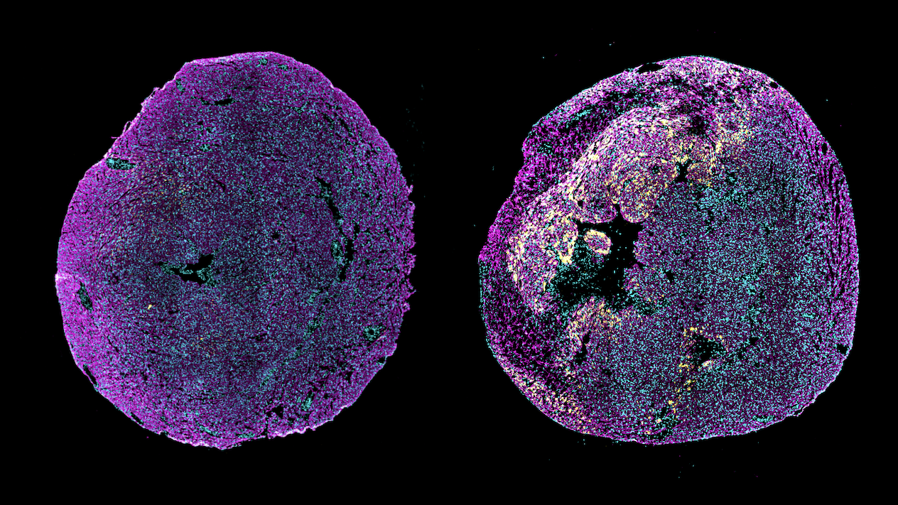 Immunofluorescence image of transverse heart sections from a healthy neonatal mouse (Left) or a neonatal mouse in which myocardial infarction was induced at postnatal day 1, examined 3 days after injury (Right)
