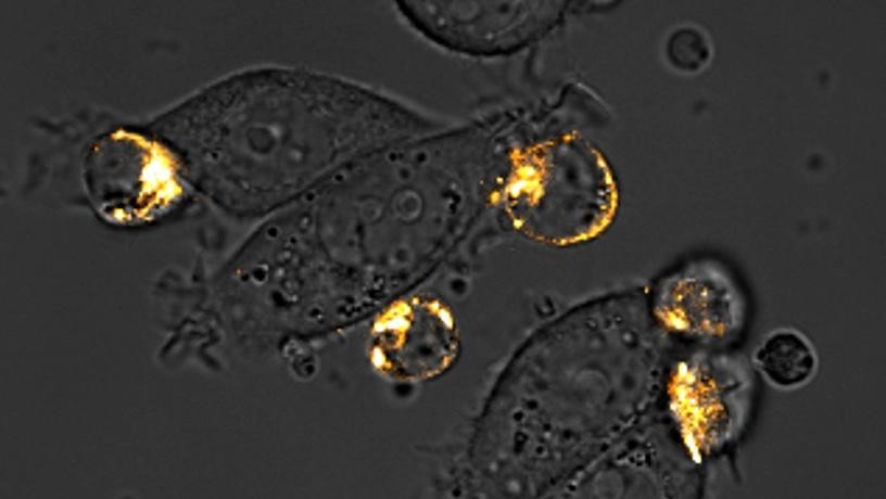 癌を死滅させるT細胞に腫瘍上の標的を描かせる細菌を開発(Engineered Bacteria Paint Targets on Tumors for Cancer-killing T Cells to See)