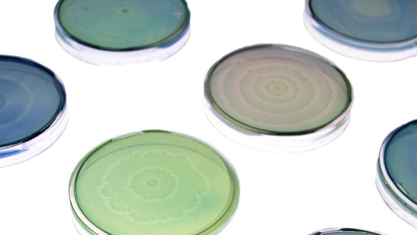 proteus mirabilis on nutrient agar
