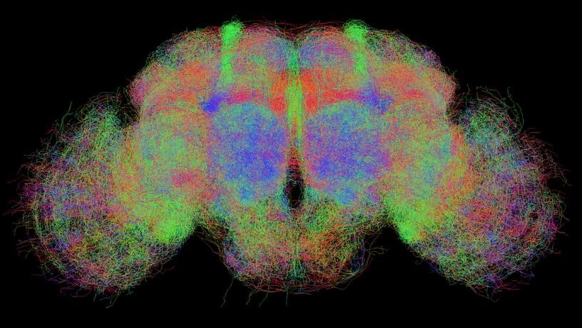 MRI brain scan