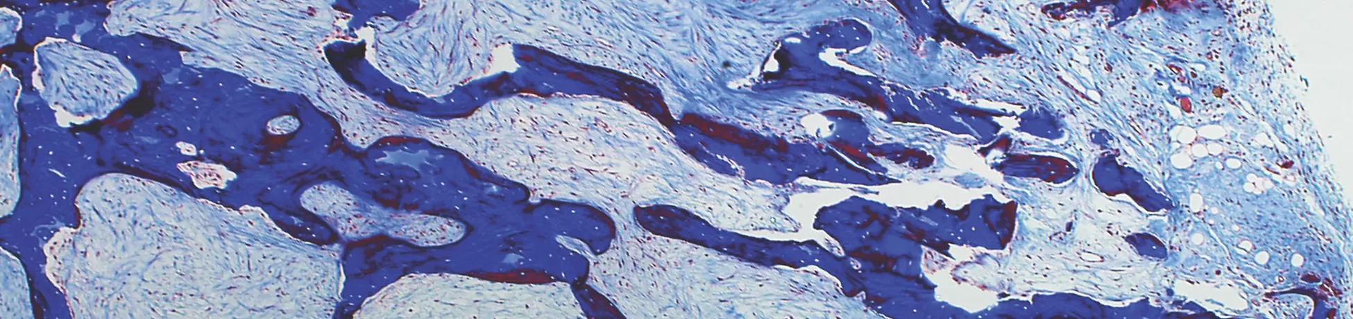 Histology micrograph of engineered bone in a trichome, showing irregular dark-blue trabecular bone-like matrix with pale blue tissue spaces and scattered red-stained regions near the surface.