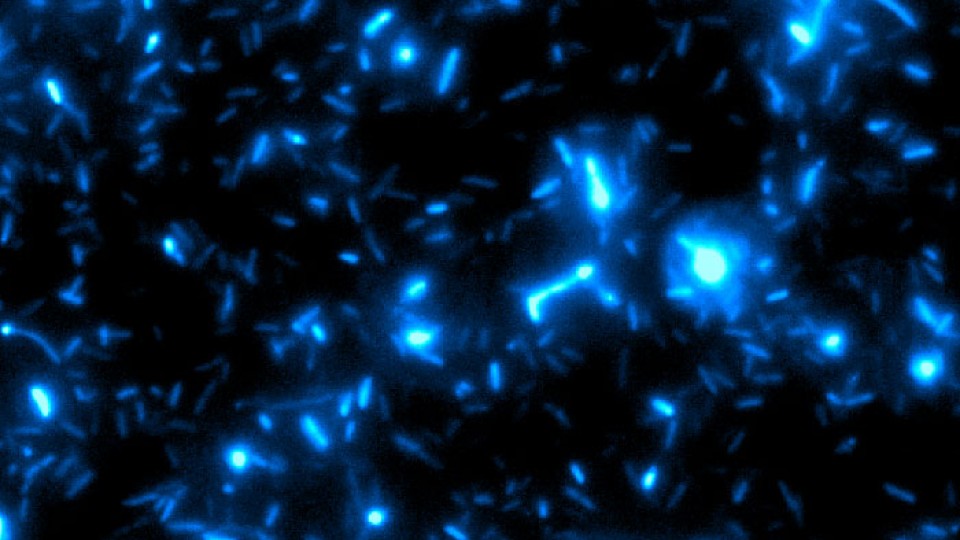 microscope image of bacteria