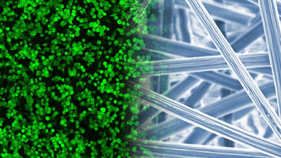 electrospun fibers for tissue regeneration