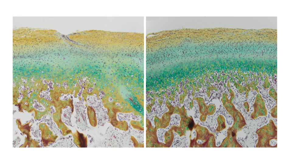 stratification_816