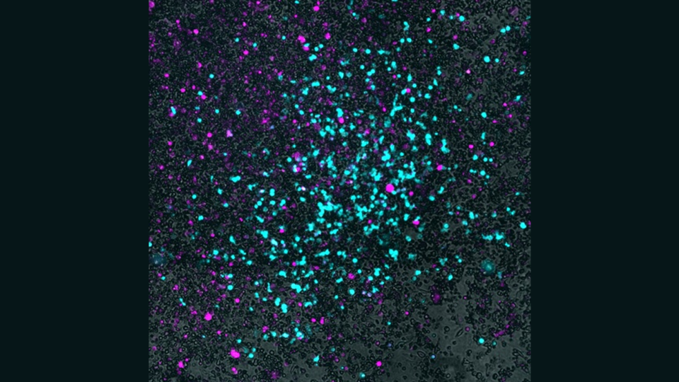 microscopic image of cancer cells and virus