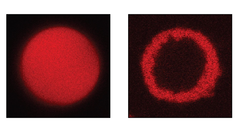 Obermeyer Bishop image