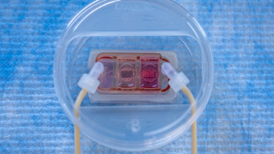 Organ-on-a-chip device inside a clear plastic dish, with two tubes connected to a small, light-red microfluidic chamber used to study how cancer spreads through blood flow to organs