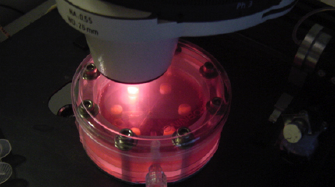 Stem Cells being researched