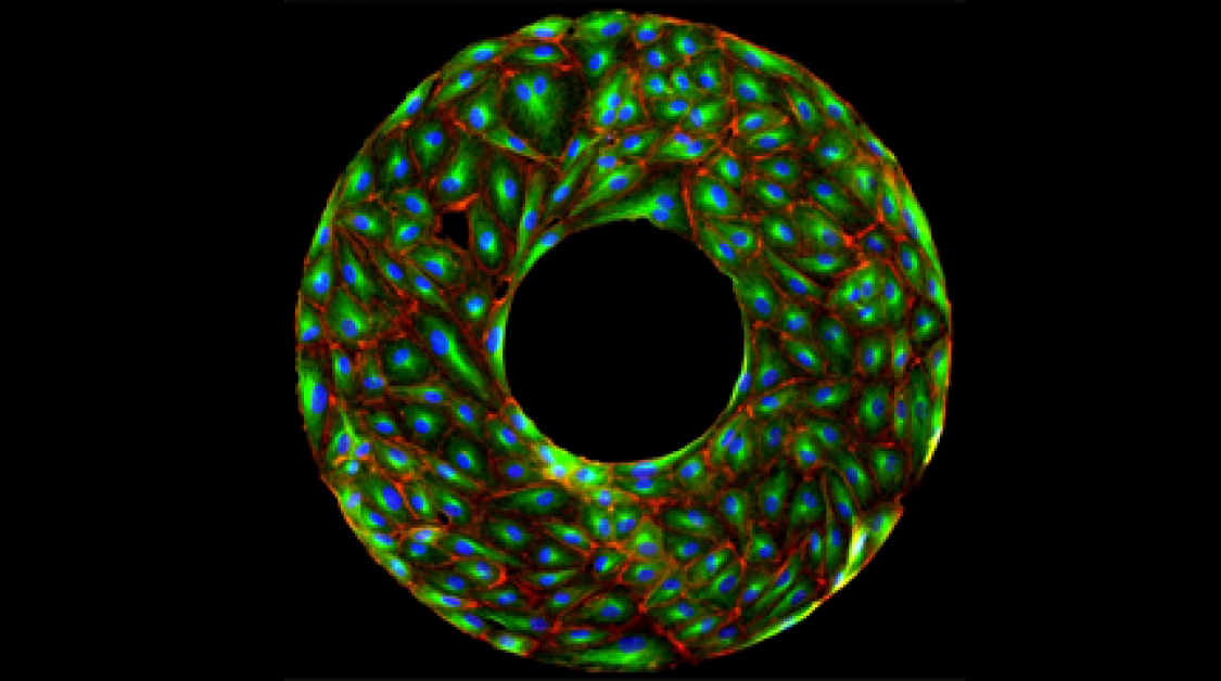 A cross section of bone growth