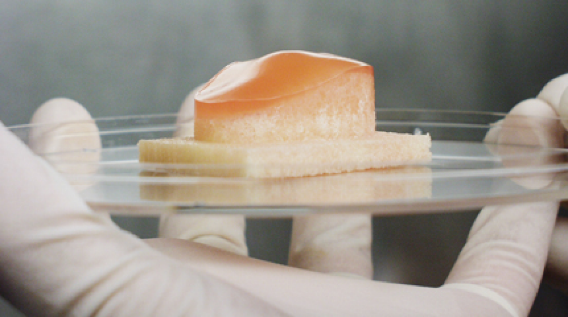 Human Patella in a petri dish