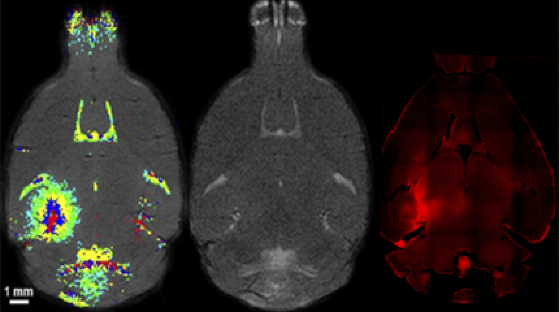 A brain scan
