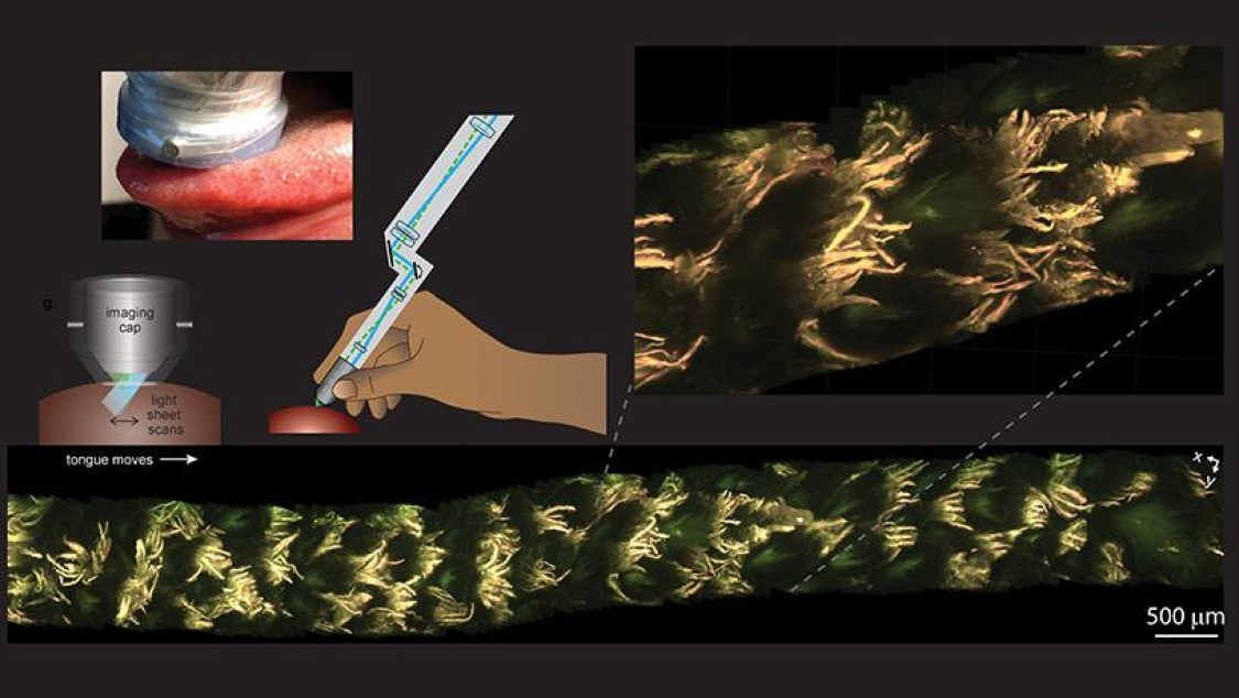 MediSCAPE imaging of the living human tongue.