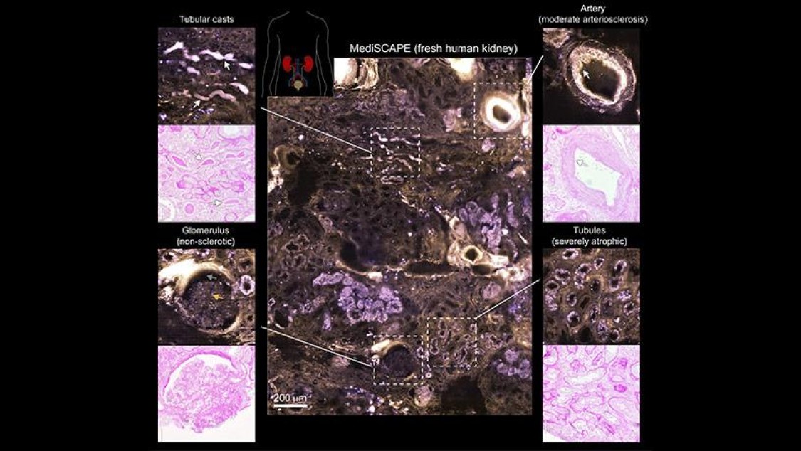MediSCAPE imaging of fresh human kidney compared to gold standard periodic acid-Schiff (PAS) histology of the same tissue. 
