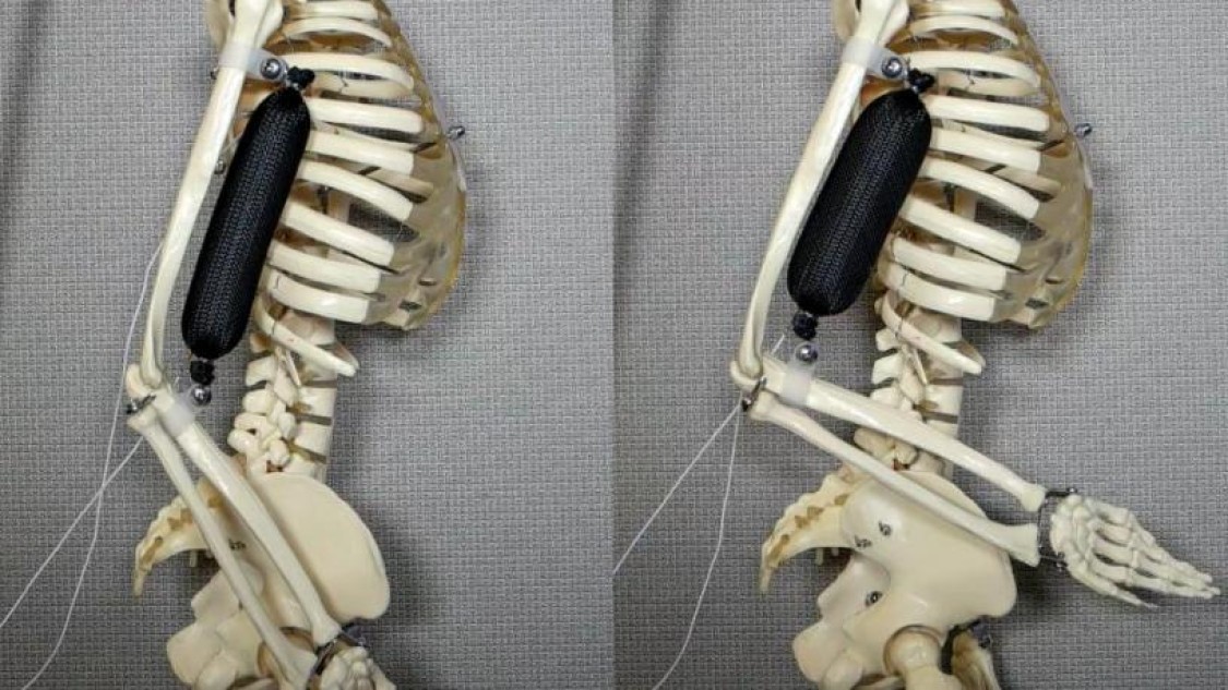 image of artificial muscle