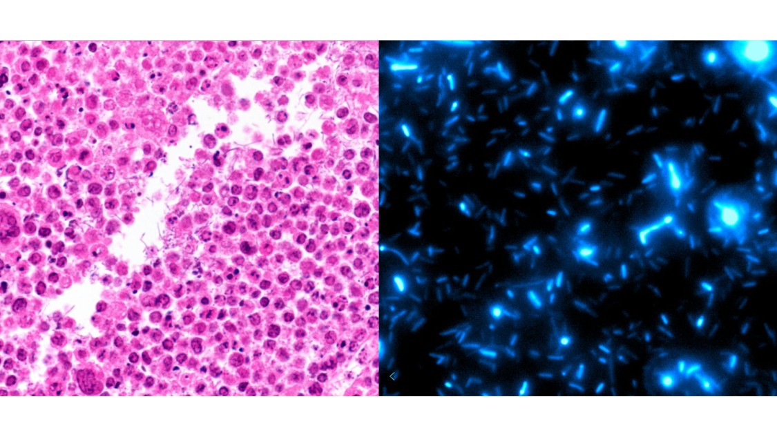magnified image of bacteria