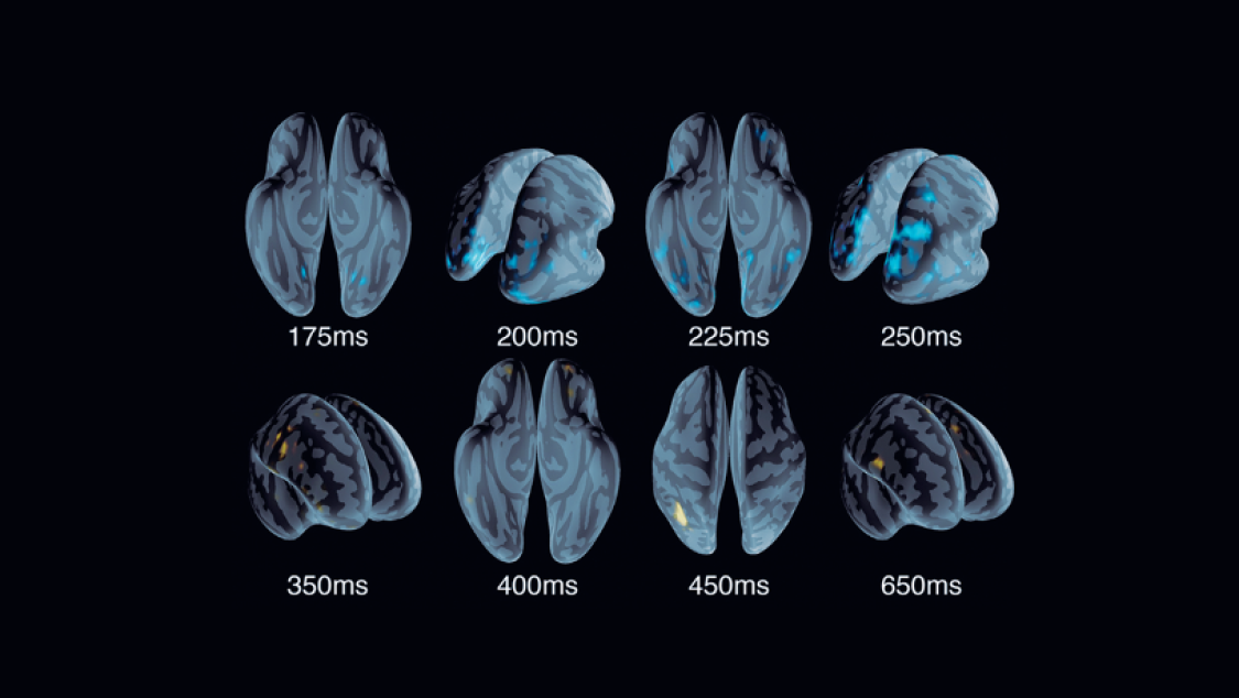 spatiotemporal_cascade_brain