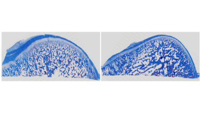 bioengineered-joint-816_0