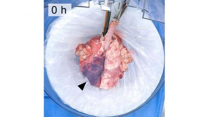 lung-0h