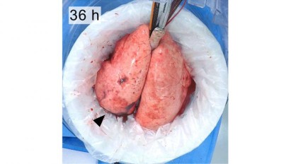 lung-36h